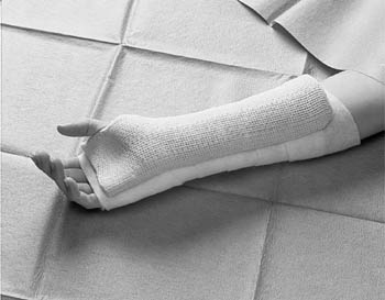 3M PRIMACAST UNPADDED SPLINTS
