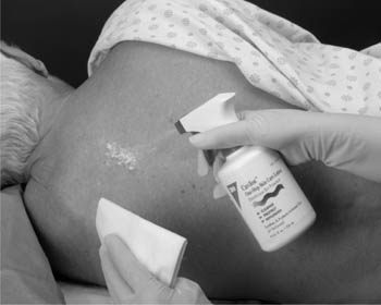 3M CAVILON ONE-STEP SKIN CARE LOTION